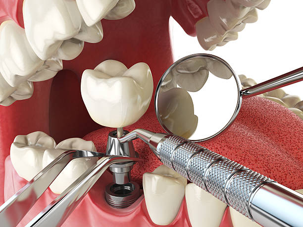 Best Emergency Dental Services for Seniors in Westfield, IN